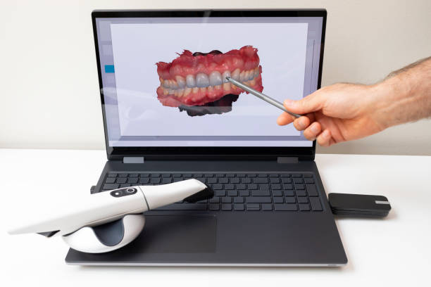 Dental X-Rays and Imaging